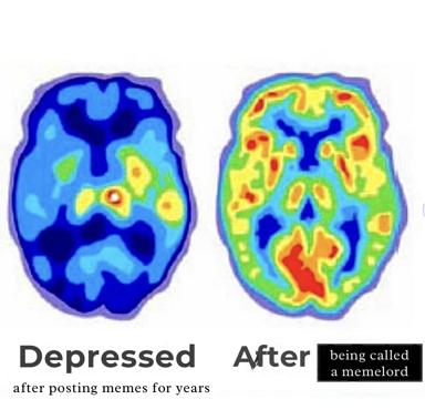 Two fMRI brain scans side by side: one muted (depression), one vivid with activity (after internet validation); a wry comment on dopamine hits from online recognition.